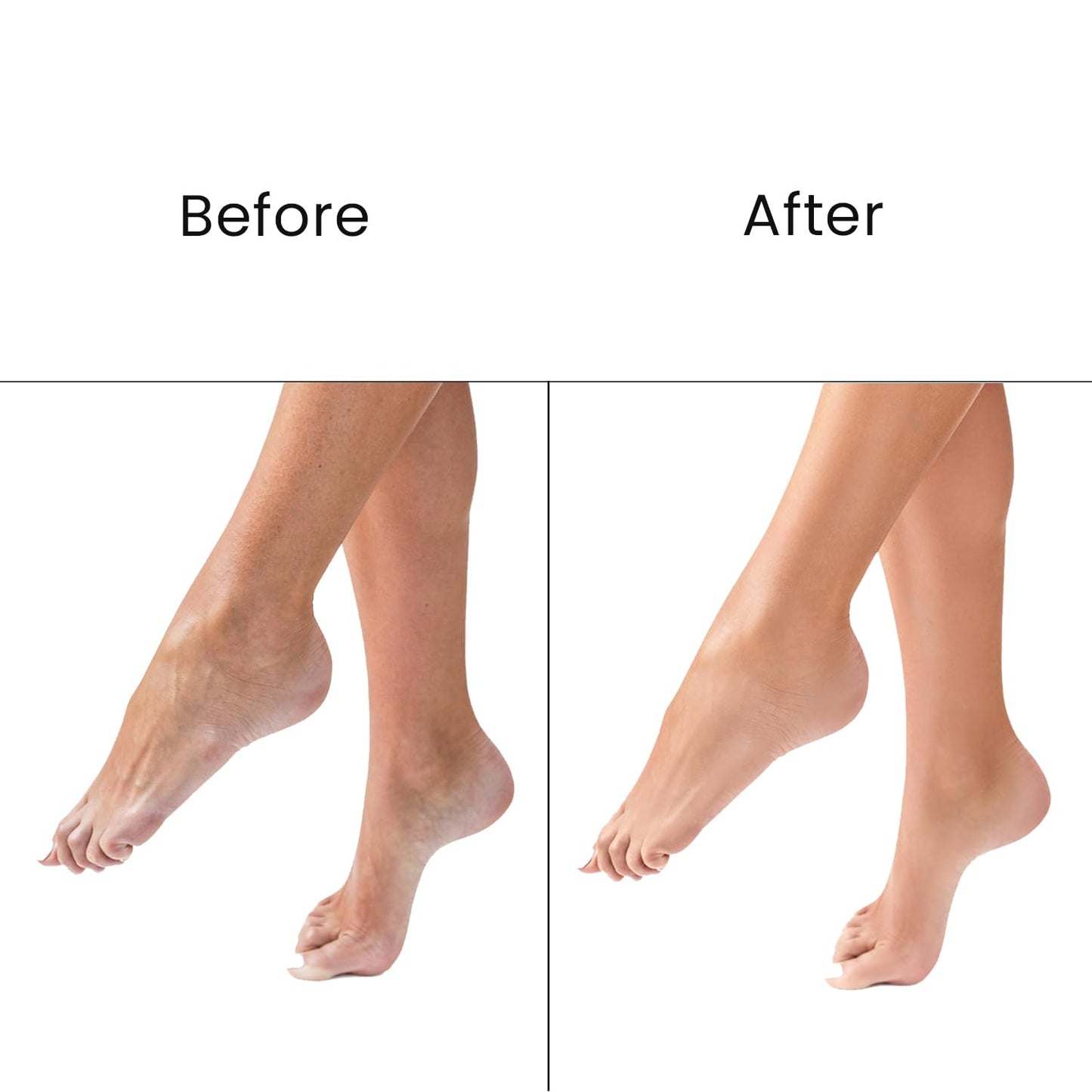 O3+ Pedilogix Scoop Bomb Pedicure with Bath Bomb for Soft & Moisturised Feet | 100g+10ml