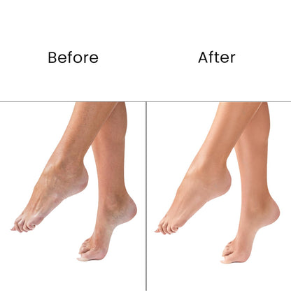 O3+ Pedilogix Scoop Bomb Pedicure with Bath Bomb for Soft & Moisturised Feet | 100g+10ml