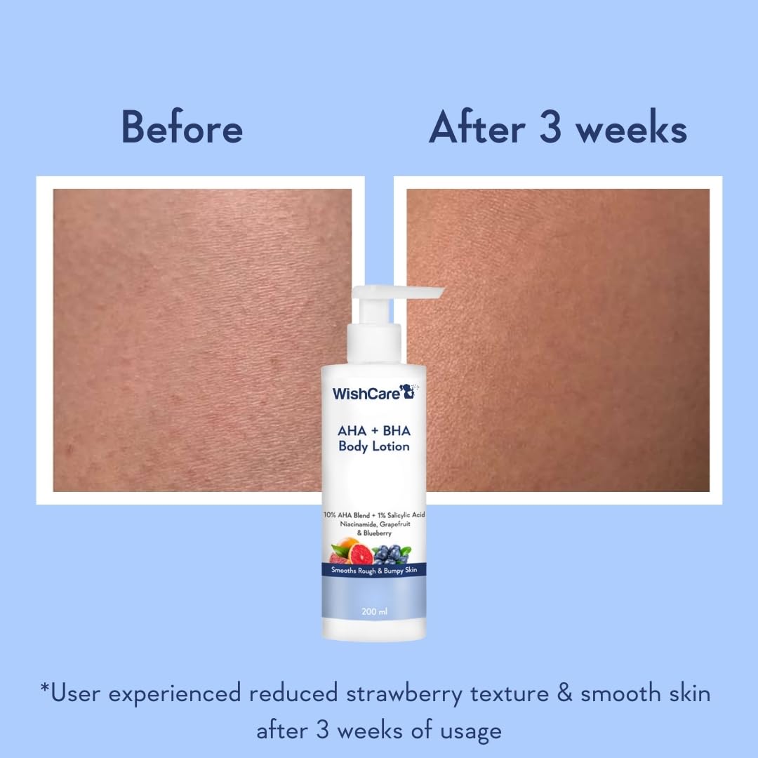 WishCare AHA BHA Body Lotion bottle with 'Before' and 'After 3 weeks' skin comparison on a blue background.