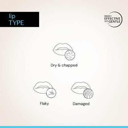 Diagram of lip types including dry and chapped, flaky, and damaged lips on a light background.