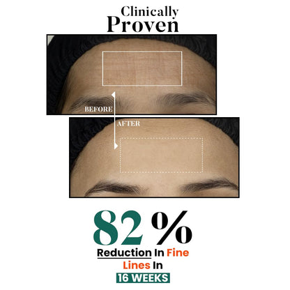Bio Code 0.1% Exosome & 0.4% PDRN Moisturizer (100ml) – For Anti-Ageing & Skin Regeneration | With 1.5% Peptide Complex, 1% Ceramide Complex & 0.5% Squalane | AI-Enhanced Formula | Dermatologist Recommended