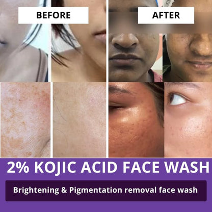 BAKE 2% Kojic Acid Brightening Face Wash Dual Action Formula with Alpha Arbutin & Niacinamide | De-Tan Wash | For Pigmentation, Dark Spots & Tan Removal | Anti Pigmentation Daily Wash - 100ml