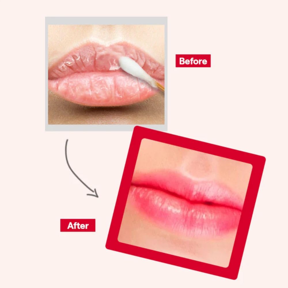 MEDIHEAL Pantenolips Healbalm Lip Balm for Dry Lips | Korean Lip Repair Balm for Cracked, Chapped & Peeling Lips with Deep Moisture Care (10ml)