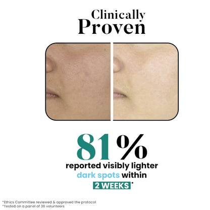 Bio Code 2% Tranexamic Acid & 5% Vitamin C Radiance Renewal Serum (30ml) – with 3% Niacinamide, 1.5% Hyaluronic Acid & 0.5% Vitamin E | Dermatologist Recommended