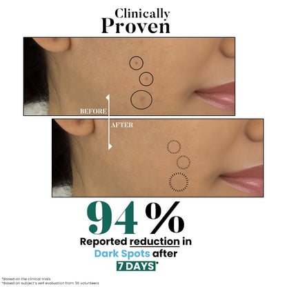 Before and after comparison of dark spots on skin with clinical proven text and 94% reduction statistic.
