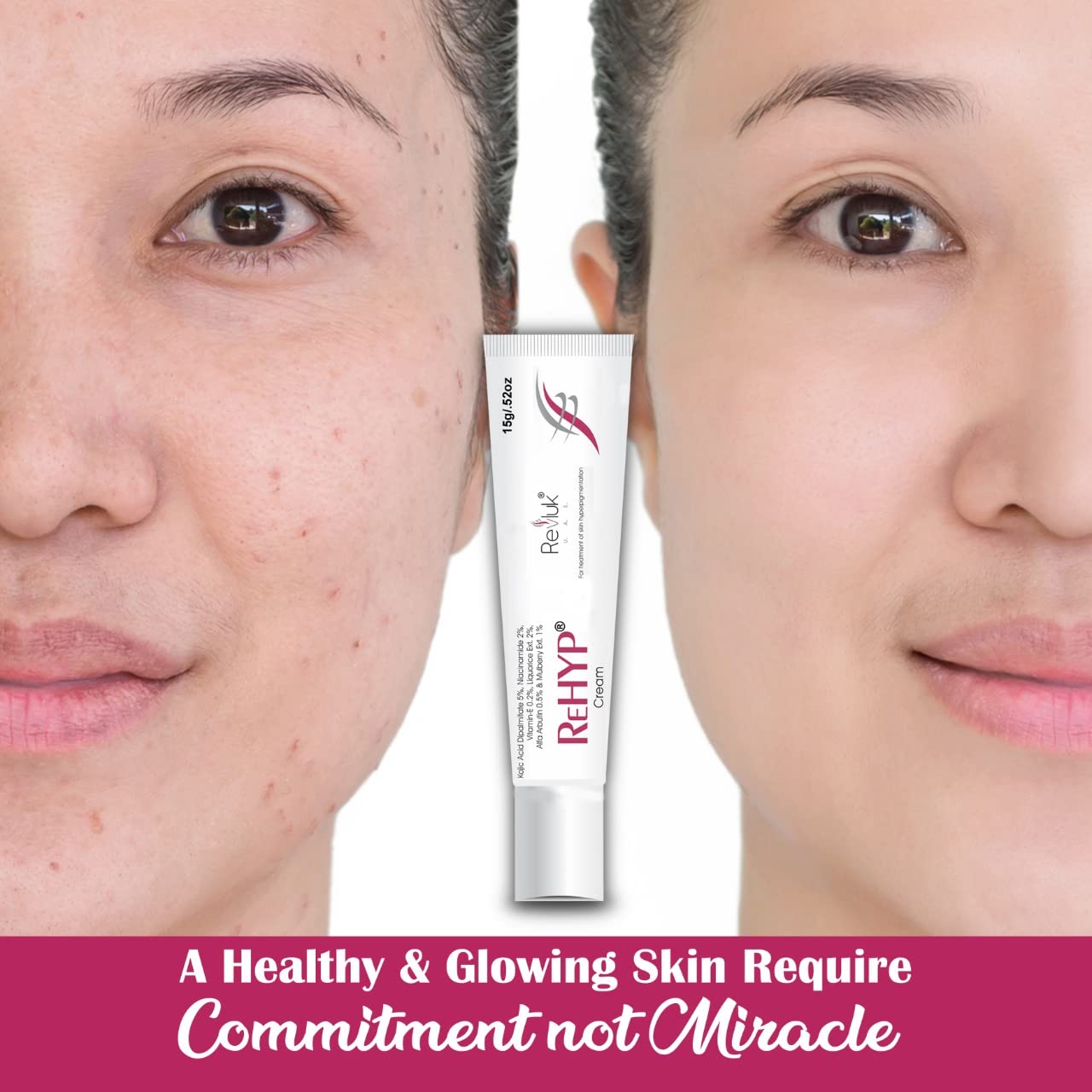 Rehyp Pigmentation Cream for Women – Dark Spot Remover, Brightening Face Cream with Kojic Acid & Alpha Arbutin – Paraben-Free, Dermatologically Tested – 15g