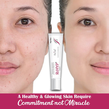 Rehyp Pigmentation Cream for Women – Dark Spot Remover, Brightening Face Cream with Kojic Acid & Alpha Arbutin – Paraben-Free, Dermatologically Tested – 15g