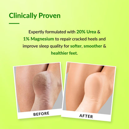 Fixderma Foobetik 30 Sec Pedicure Combo for Dry & Cracked Feet | Foot Scrub Spray + 20% Urea Foot Roll On | Removes Dead Skin & Calluses | Repairs Cracked Heels & Deeply Moisturizes Feet | 110ml