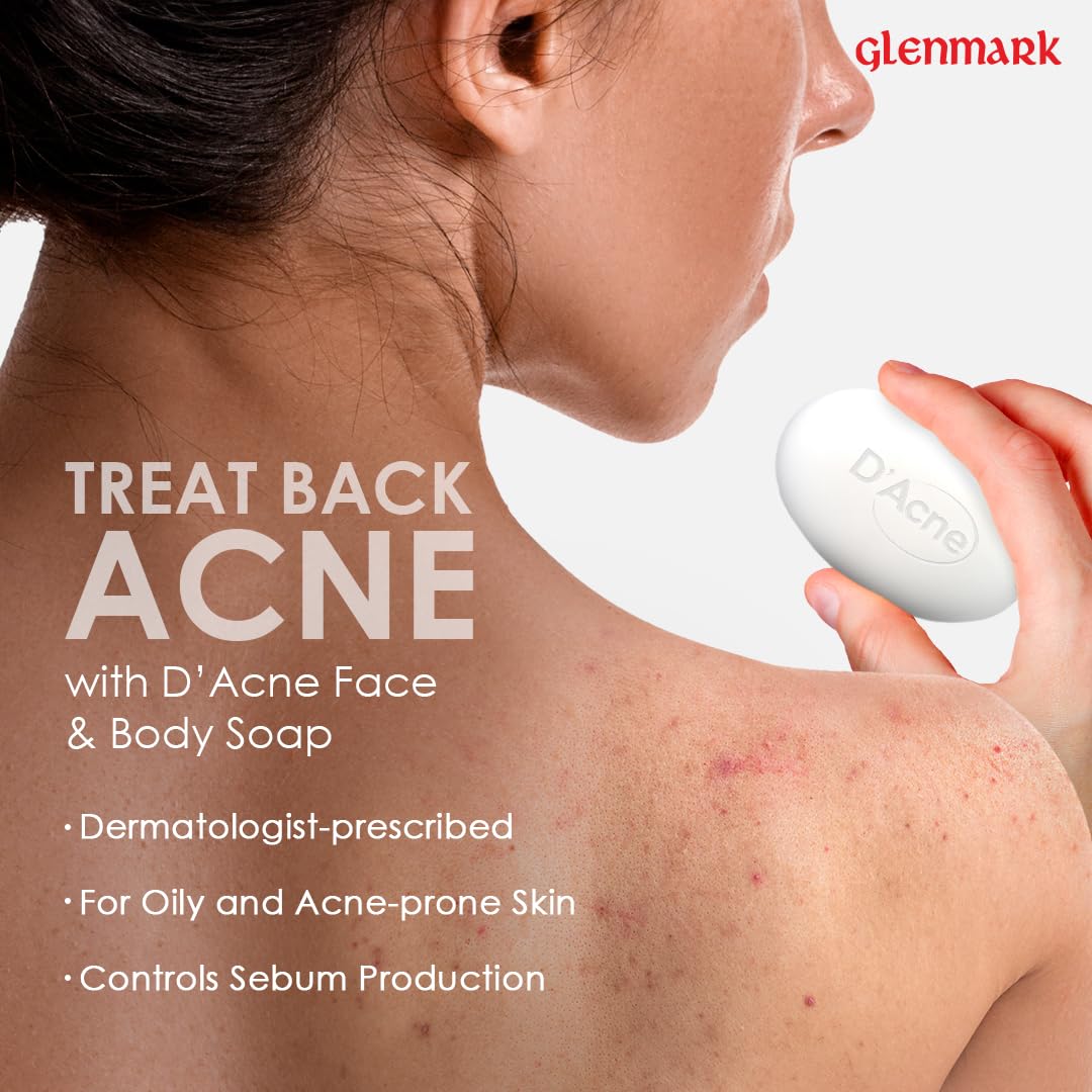 Person holding D'Acne Face & Body Soap with text about treating acne on a white background