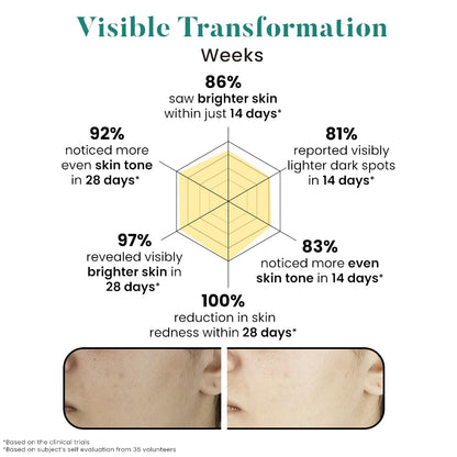 Bio Code 2% Tranexamic Acid & 5% Vitamin C Radiance Renewal Serum (30ml) – with 3% Niacinamide, 1.5% Hyaluronic Acid & 0.5% Vitamin E | Dermatologist Recommended
