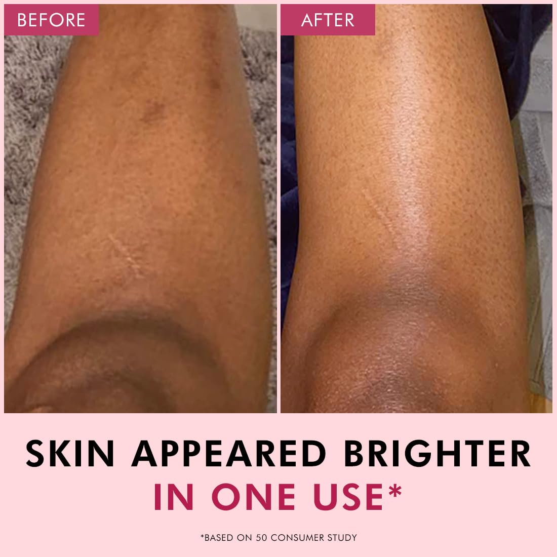 Before and after comparison of skin on a person's leg with text indicating a brighter appearance.