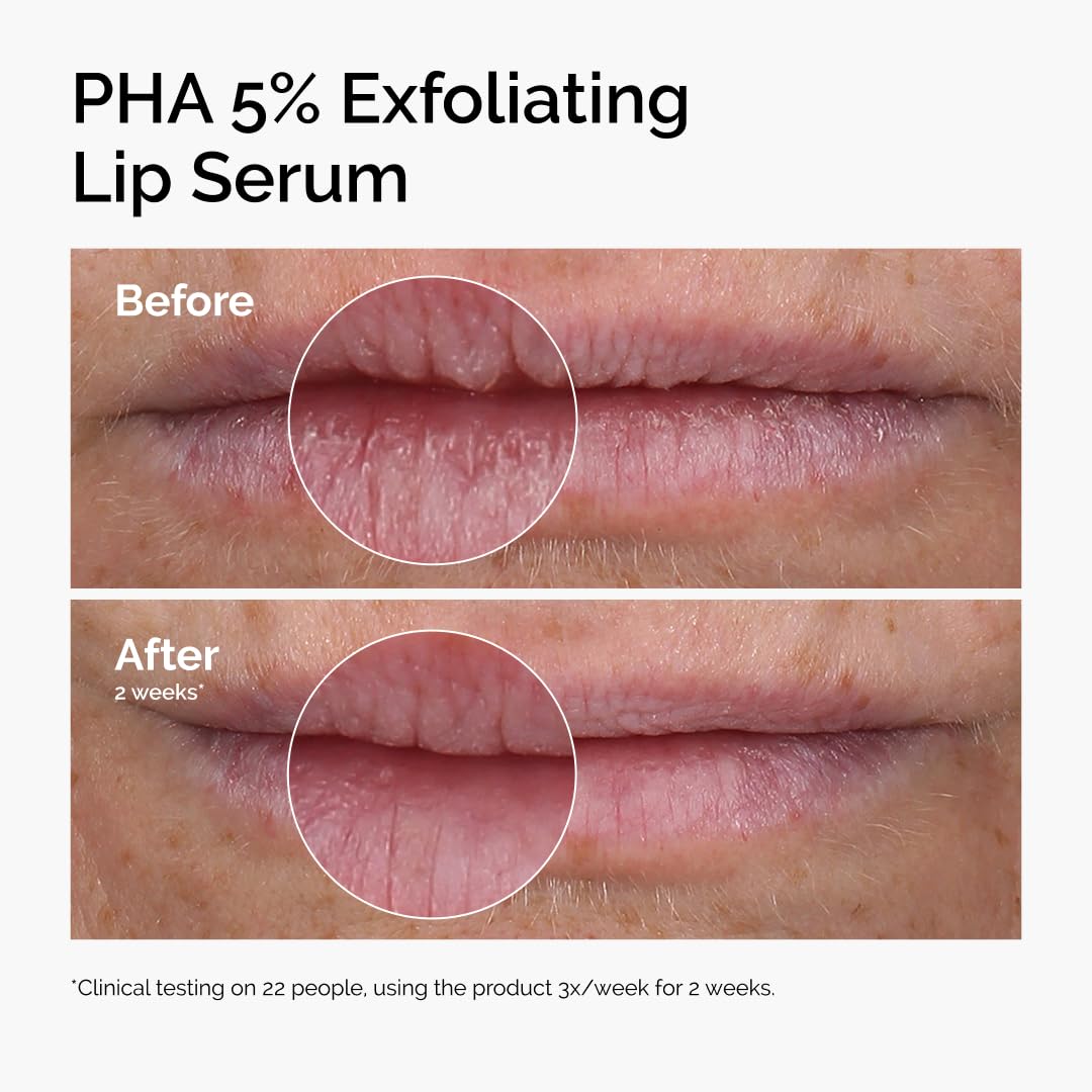 Before and after comparison of PHA 5% Exfoliating Lip Serum on lips.