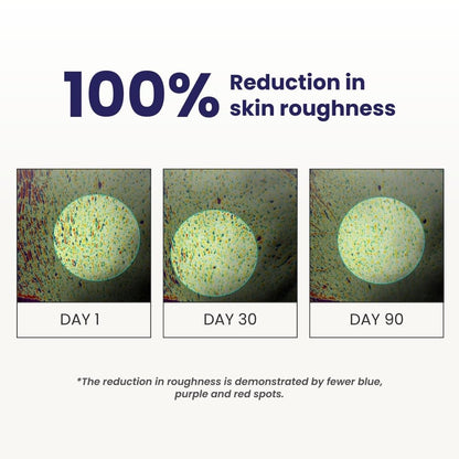 Before-and-after comparison of skin roughness reduction over 90 days with text '100% Reduction in skin roughness'.
