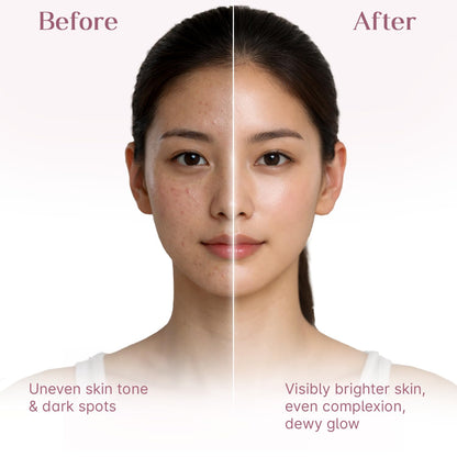 Seoulskin Kojic Acid Sunscreen SPF 50 PA ++++ | Helps Fade Dark Spots & Pigmentation | Non – Sticky & Non- Greasy | No White Cast | Broad Spectrum UVA & UVB Protection | All Skin Types | For Men & Women | Lightweight Korean Sunscreen | 50 g