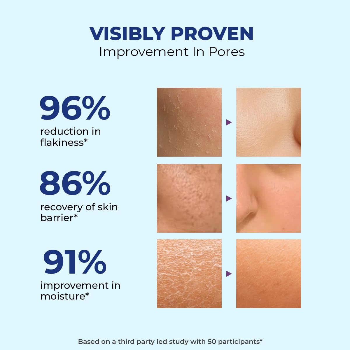 Skincare product effectiveness chart showing improvements in pores with percentages and before-and-after images.