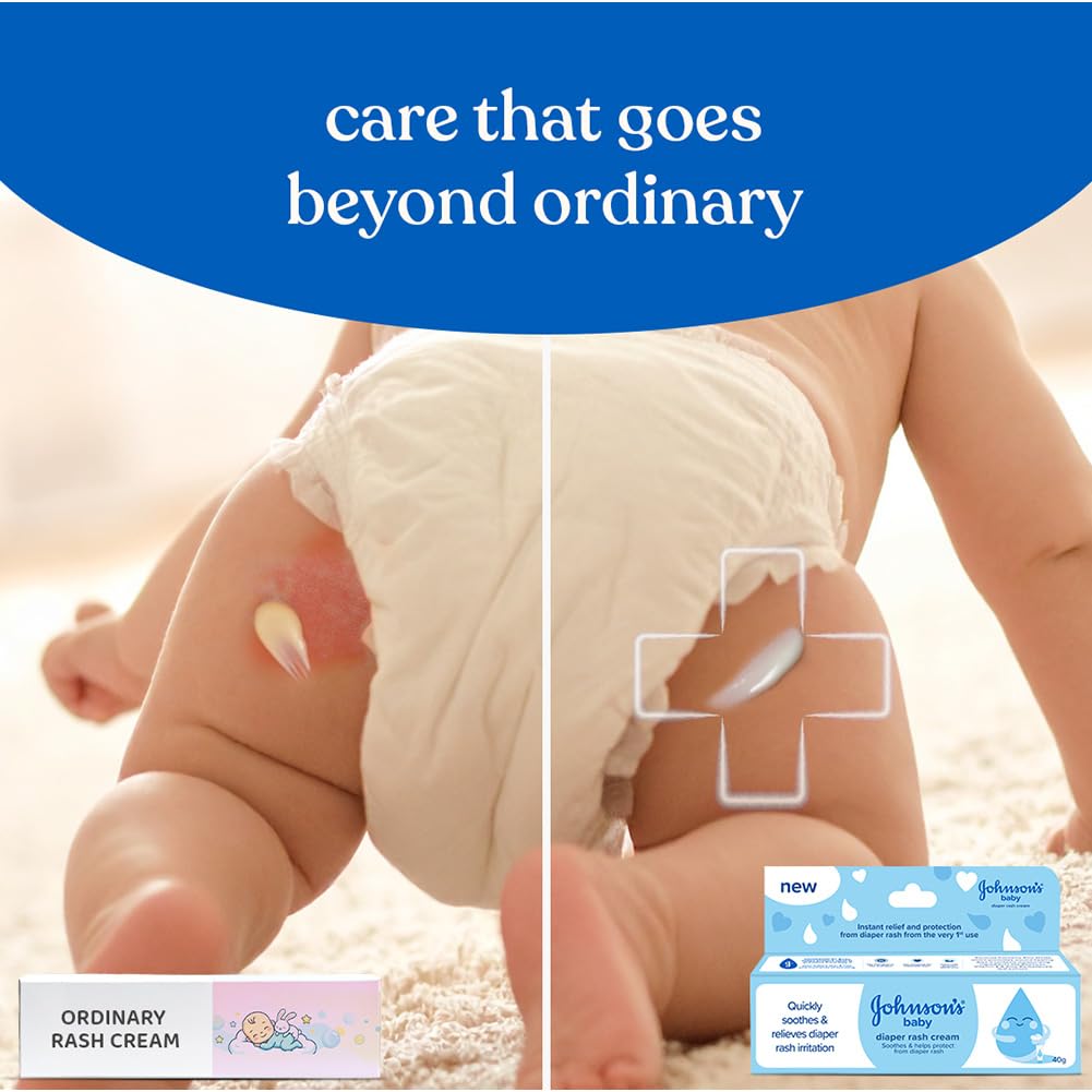Johnson's Baby Diaper Rash Cream 40g | With Aloe Vera & Natural Beeswax | For All Skin Types Including Sensitive Skin | Clinically Proven, Soothes & Prevents Diaper Rash | No Parabens & Sulphates | Paediatrician Tested