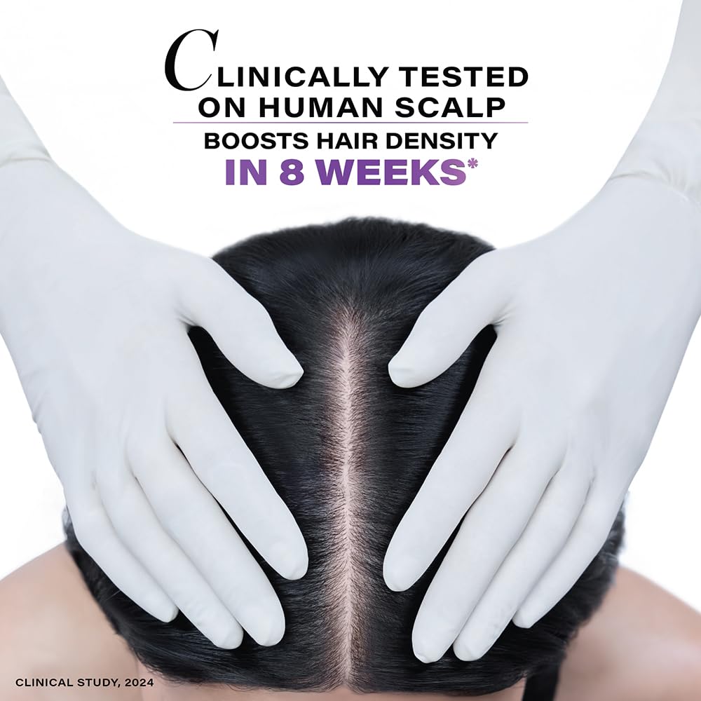 Person with gloved hands on a scalp with text about clinically tested hair density boost in 8 weeks.