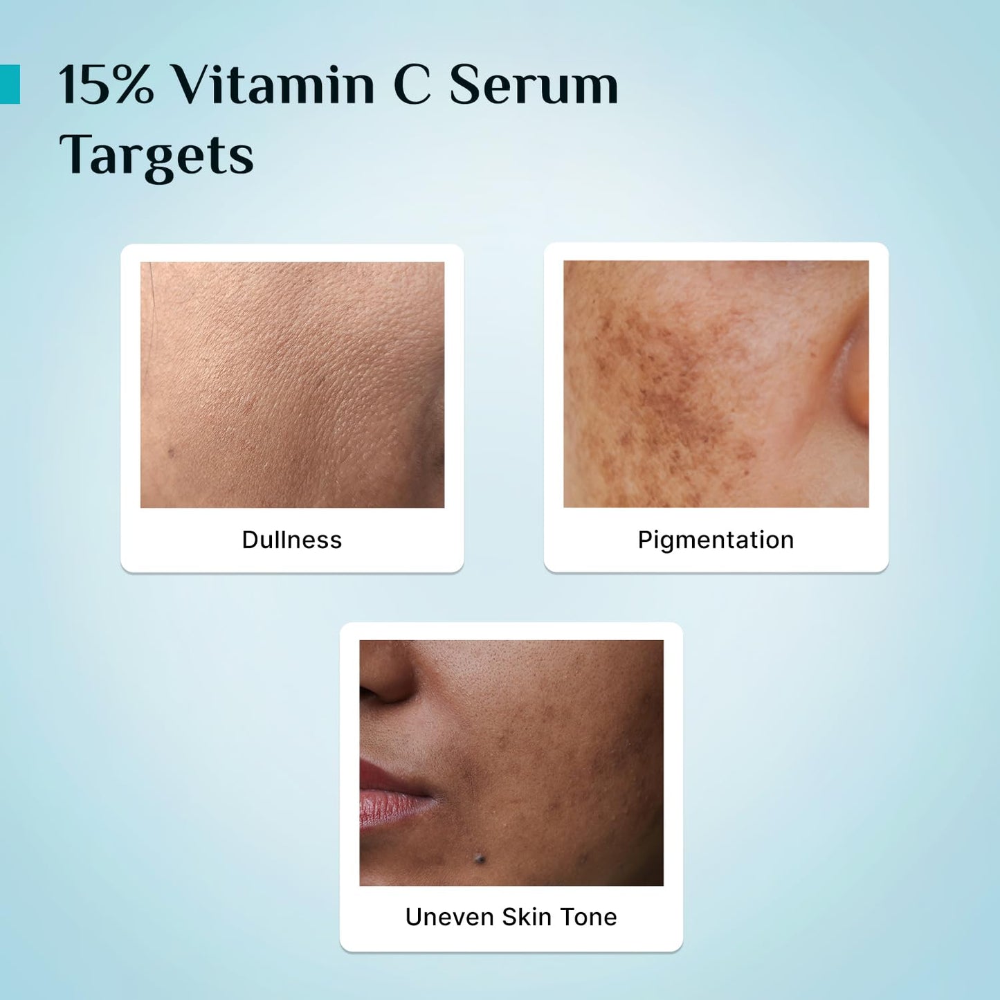 Pilgrim 15% Vitamin C Serum 10ml for Glowing Skin with Ferulic Acid & Kakadu Plum | Advanced Dark Spot Corrector, Hyperpigmentation & Brightening Face Serum | For All, Combination, Normal Skin