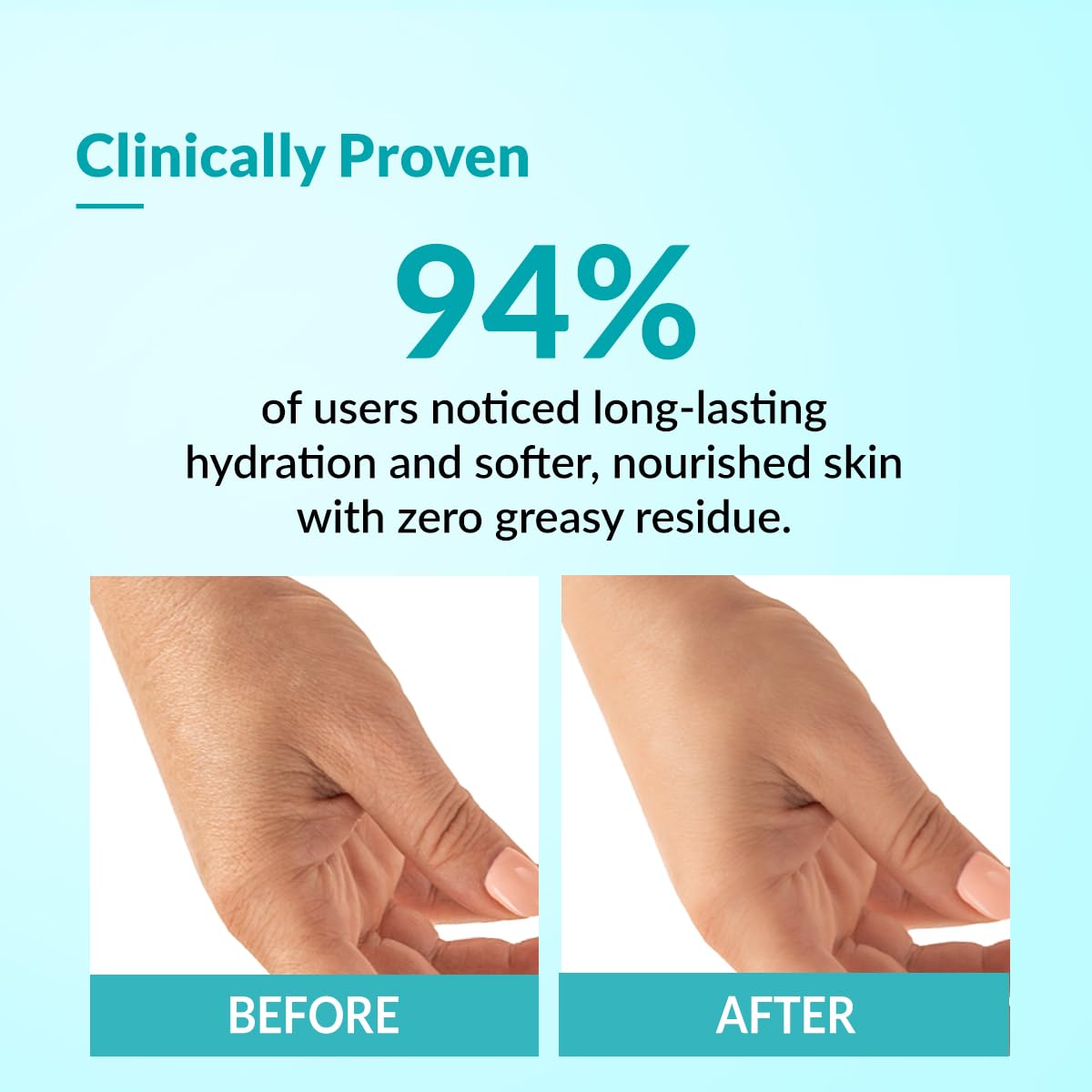 Fixderma Moisturizing lotion, Daily Moisturizer for Dry skin, Body & face moisturizer, Provides Hydration & calmness, Non-Comedogenic & Non-Greasy - 150ml
