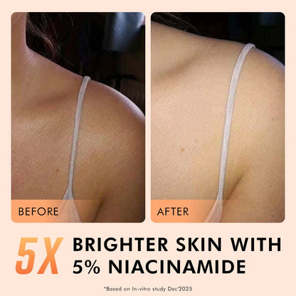 Before and after comparison of skin with 5% niacinamide, showing a brighter appearance.