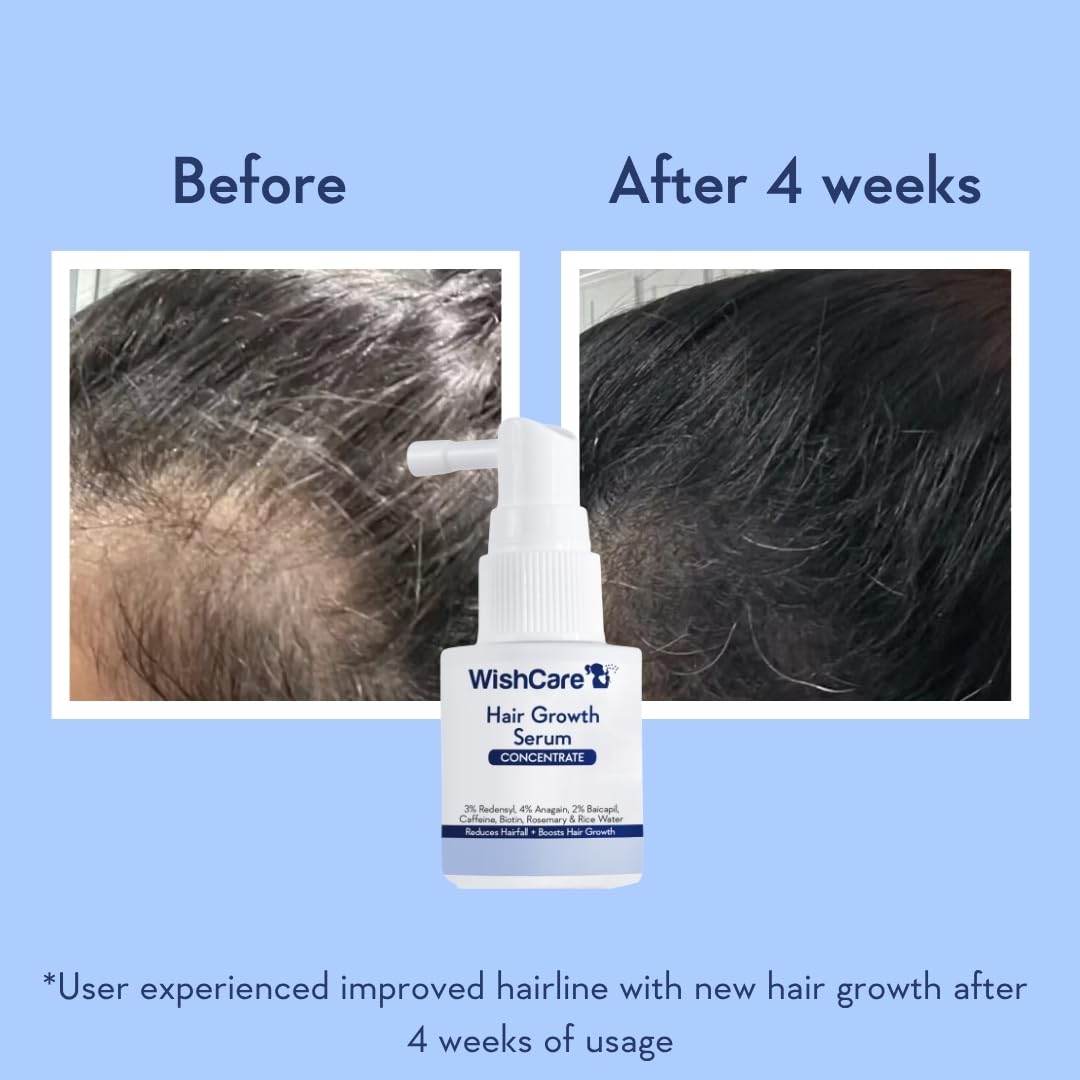 WishCare hair growth serum bottle with 'Before' and 'After' hairline comparison on a blue background