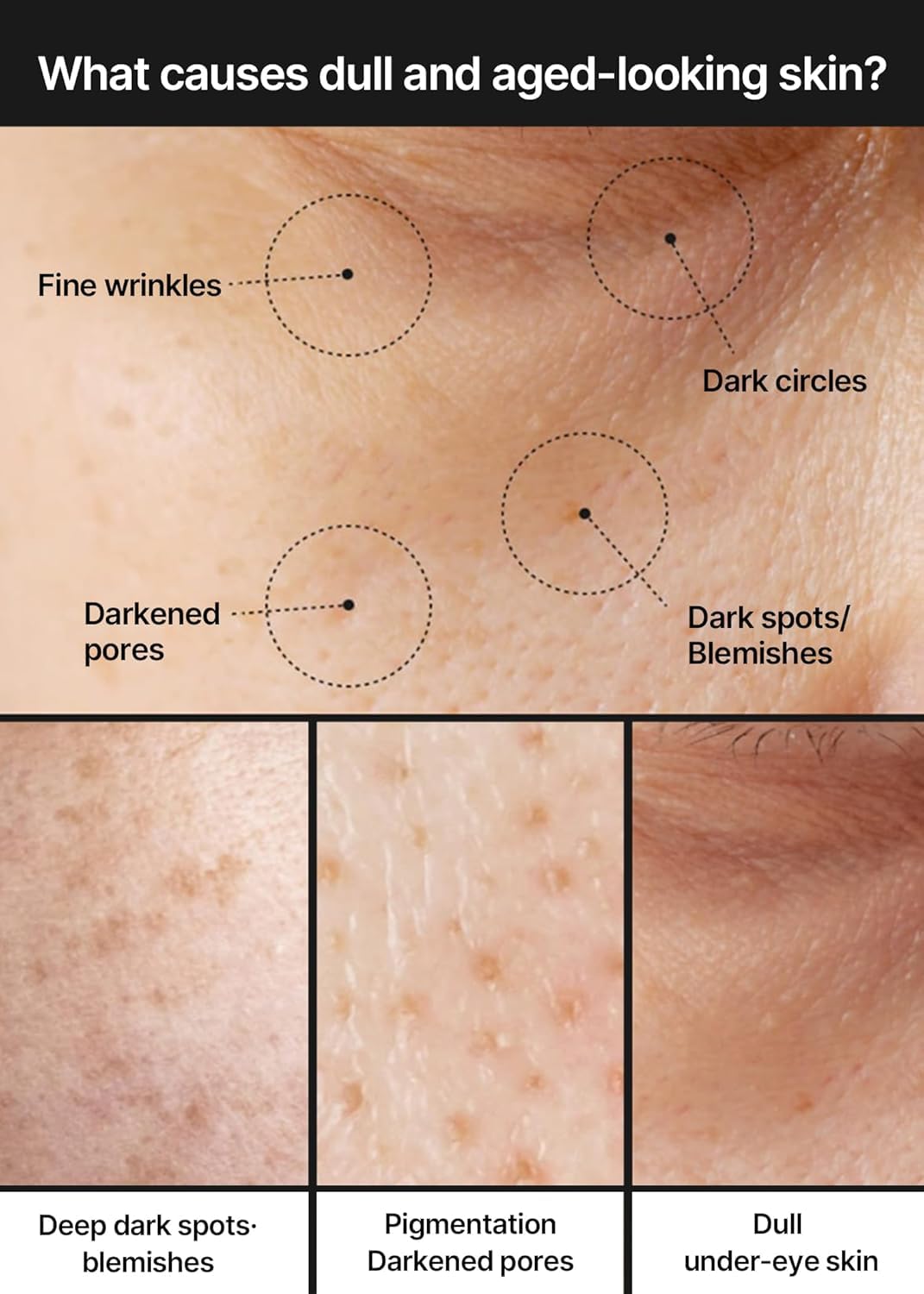 celimax Pore+Dark Spot Brightening Cream 35ml | Korean Brightening Moisturiser for Hyperpigmentation & Uneven Skin Tone | Niacinamide, Hyaluronic Acid, Ceramides & Centella | Minimises Pores, Reduces Dark Spots, Barrier Repair & Deep Hydration