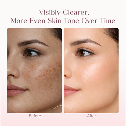 Seoulskin Kojic Acid Skin Lightening Cream with Kojic Acid, Niacinamide & Alpha Arbutin |Moisturizer | Skin Brightening | For Glowing Skin | Treats Dark Spots & Pigmentation | Tan Removal | For Men & Women