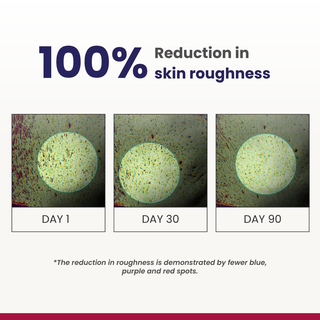 Before-and-after comparison of skin roughness reduction over 90 days with text indicating 100% reduction.