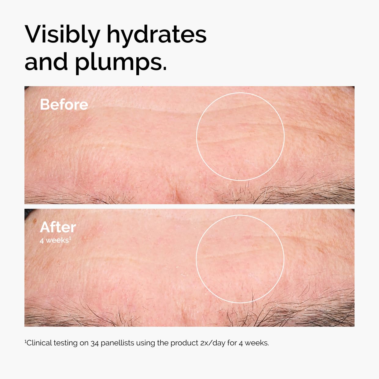 Before and after comparison of hydrated and plumped skin with text indicating clinical testing results.