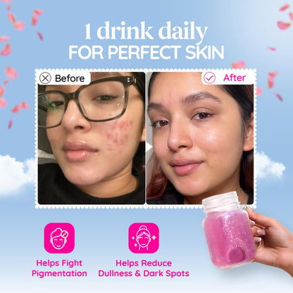 Before and after comparison of a person's face with text and a bottle labeled '1 drink daily FOR PERFECT SKIN'.