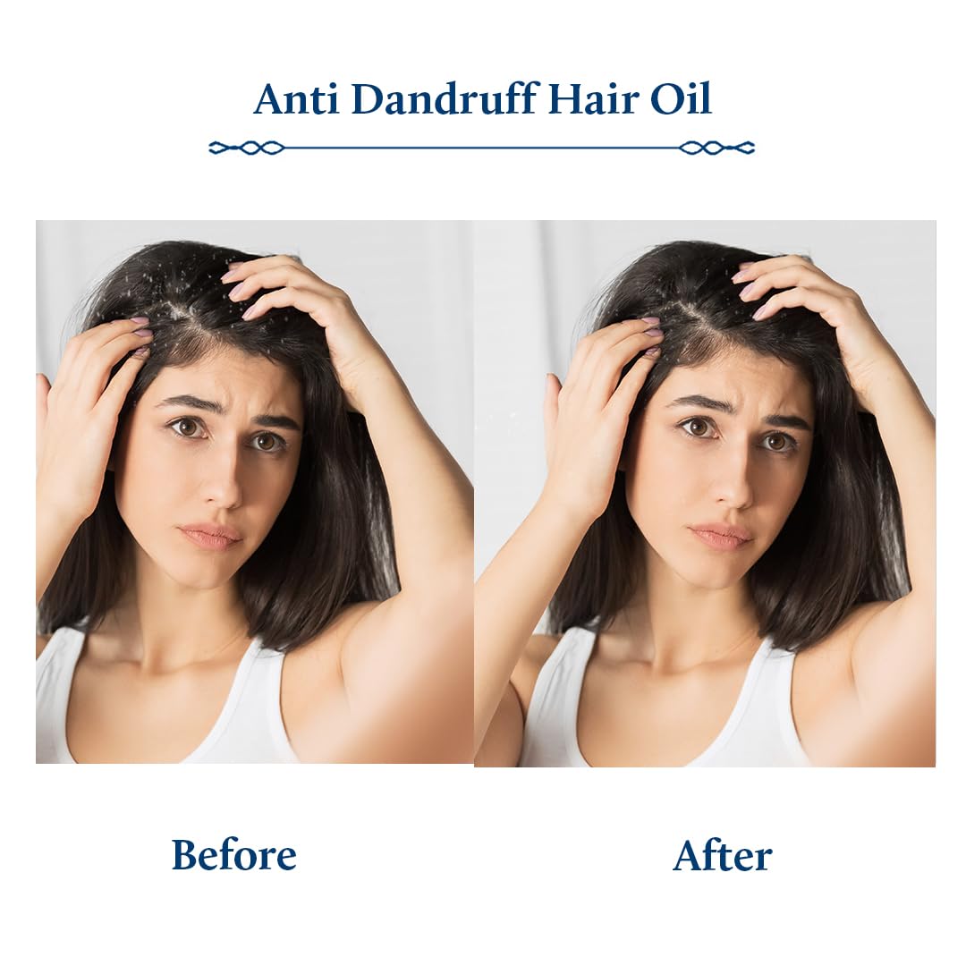 Blue Nectar Anti Dandruff Hair Oil | Ayurvedic Hair Oil with Neem, Tea Tree & Bhringraj for Hair Growth & Dandruff | Non-Sticky Hair Oil for Dry Scalp (12 Herbs, 100ml)