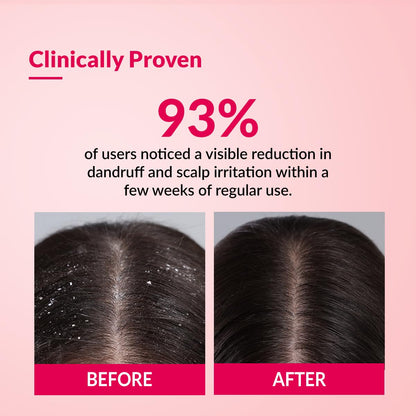 Fixderma Bioteez-S, Anti Dandruff Shampoo, Flaky Scalp Condition, Nourish Dry Hair, Relieves Itchy & Dry Scalp, Recurrent Dandruff, Sulphate & Paraben Free Formulation - 75ml