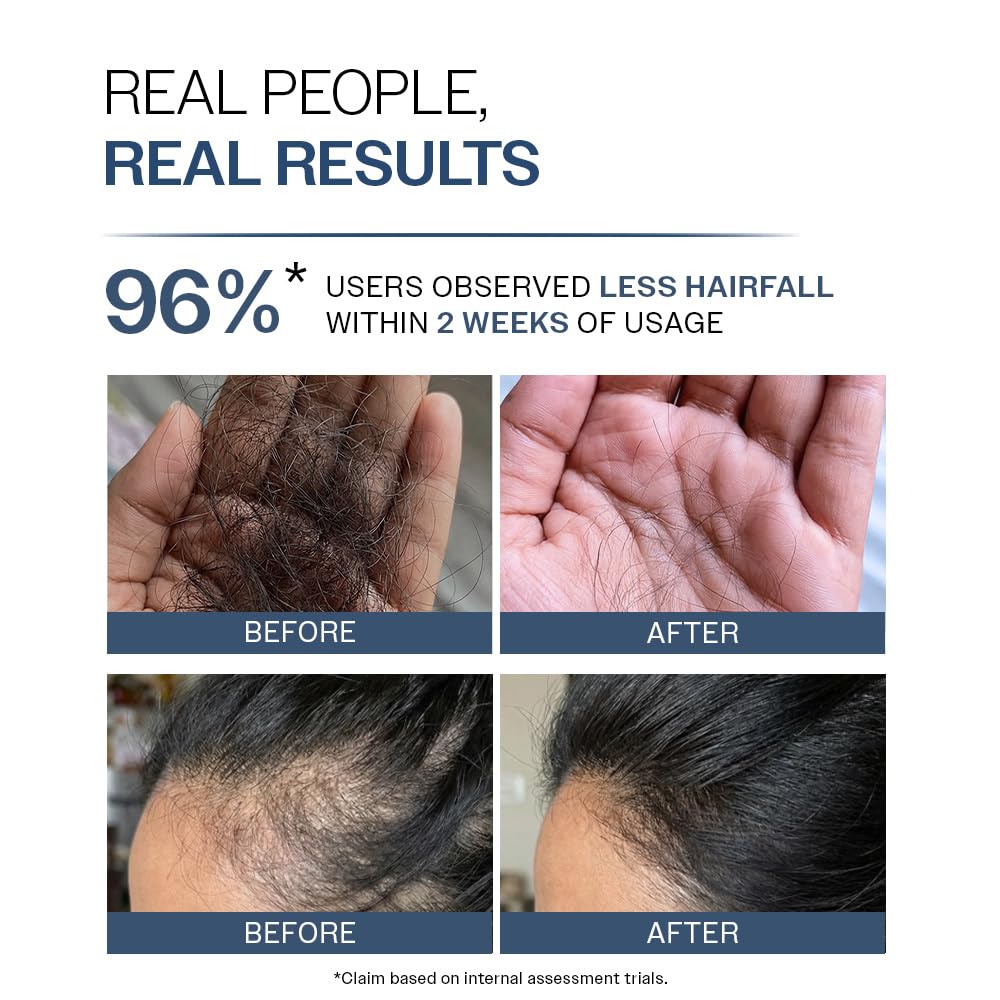 Before and after hairfall reduction results with text 'Real People, Real Results' and '96% users observed less hairfall within 2 weeks of usage'.