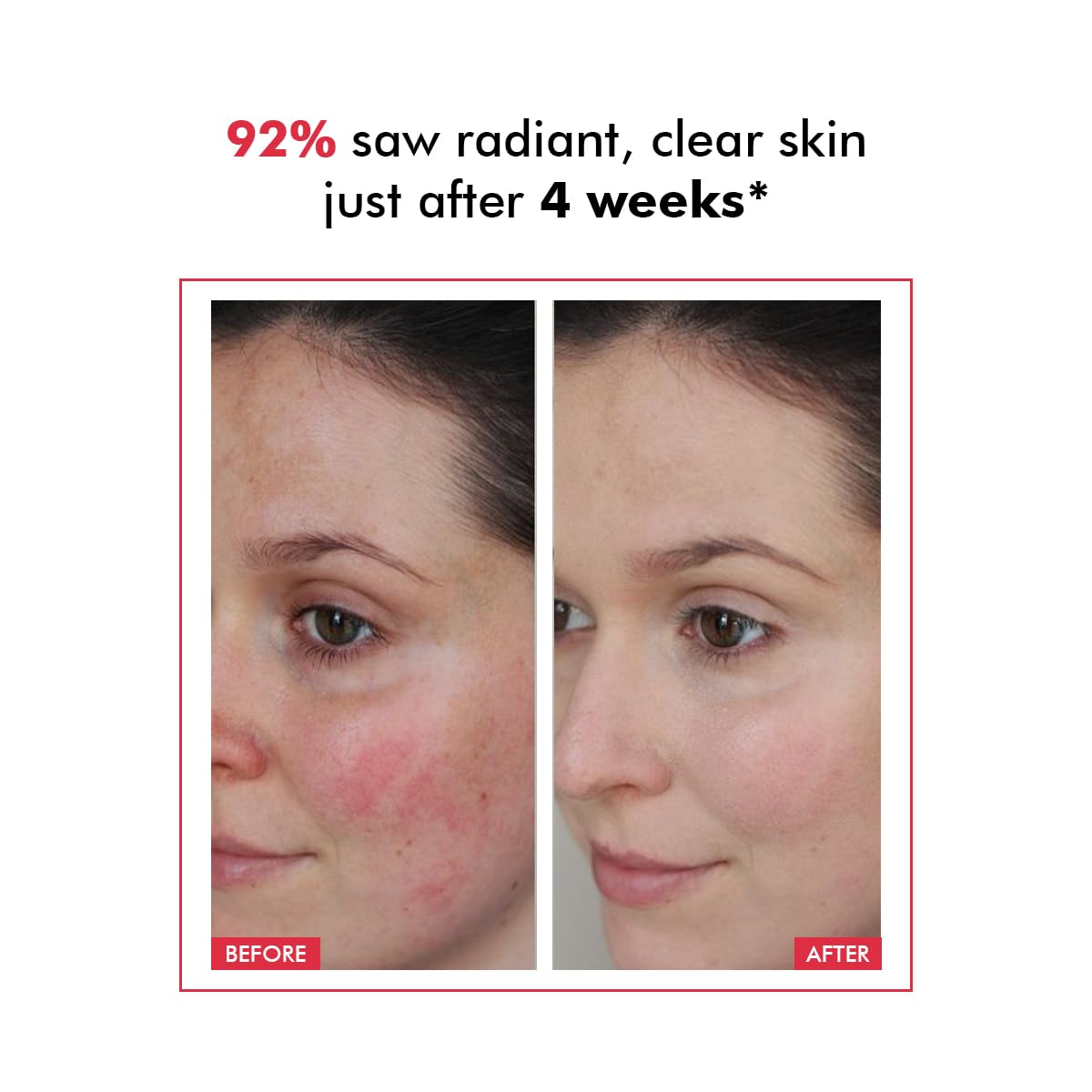 Before and after comparison of skin with text indicating improvement after 4 weeks.