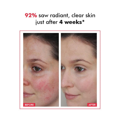 Before and after comparison of skin with text indicating improvement after 4 weeks.