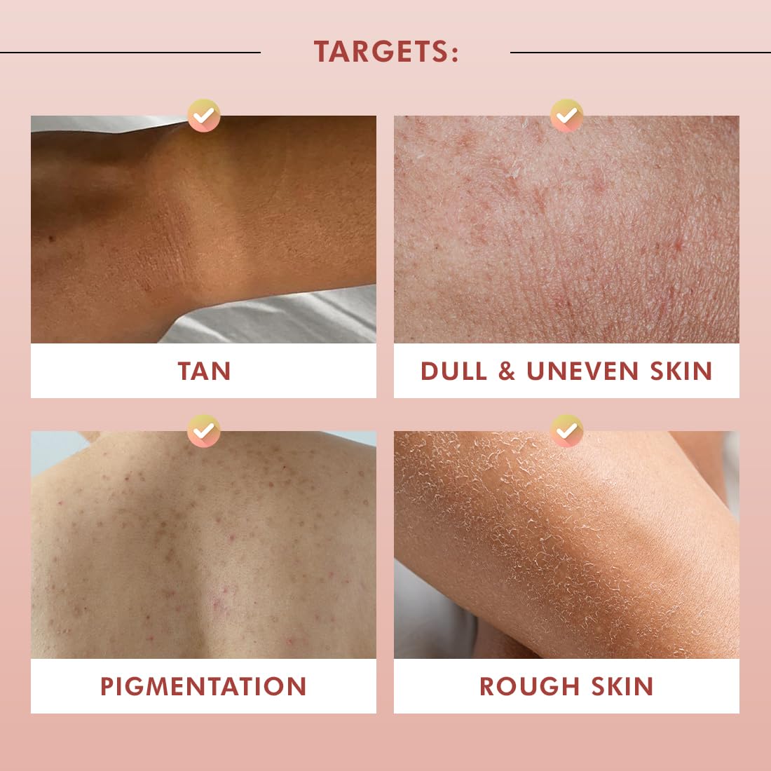 Collage of skin conditions targeted by a skincare product on a pink background.