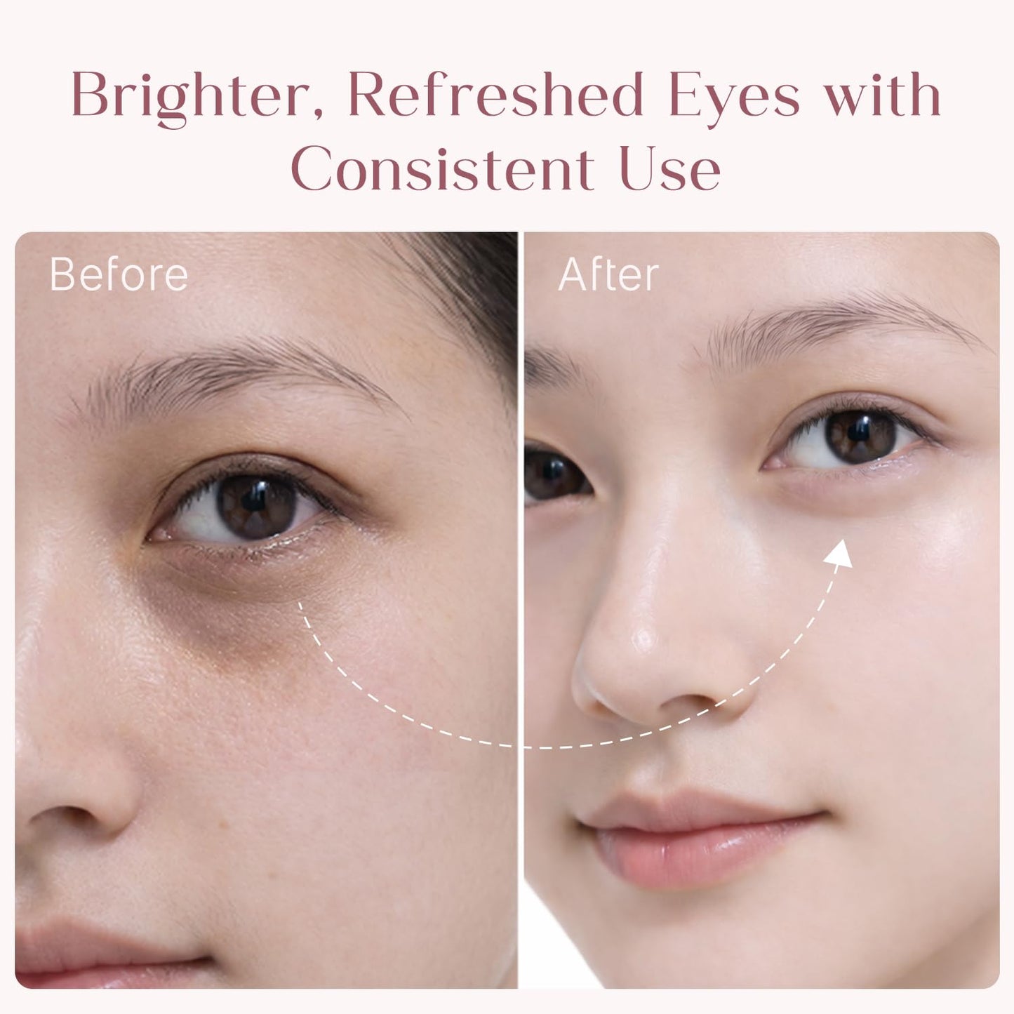Seoulskin under eye cream | dark circles removal for women and men | Under Eye Gel to Reduce Dark Circles, Puffiness & Wrinkles With Built-in Cooling Massage Roll-On Applicator | 5% Niacinamide, 2% Alpha Arbutin | 15 ml