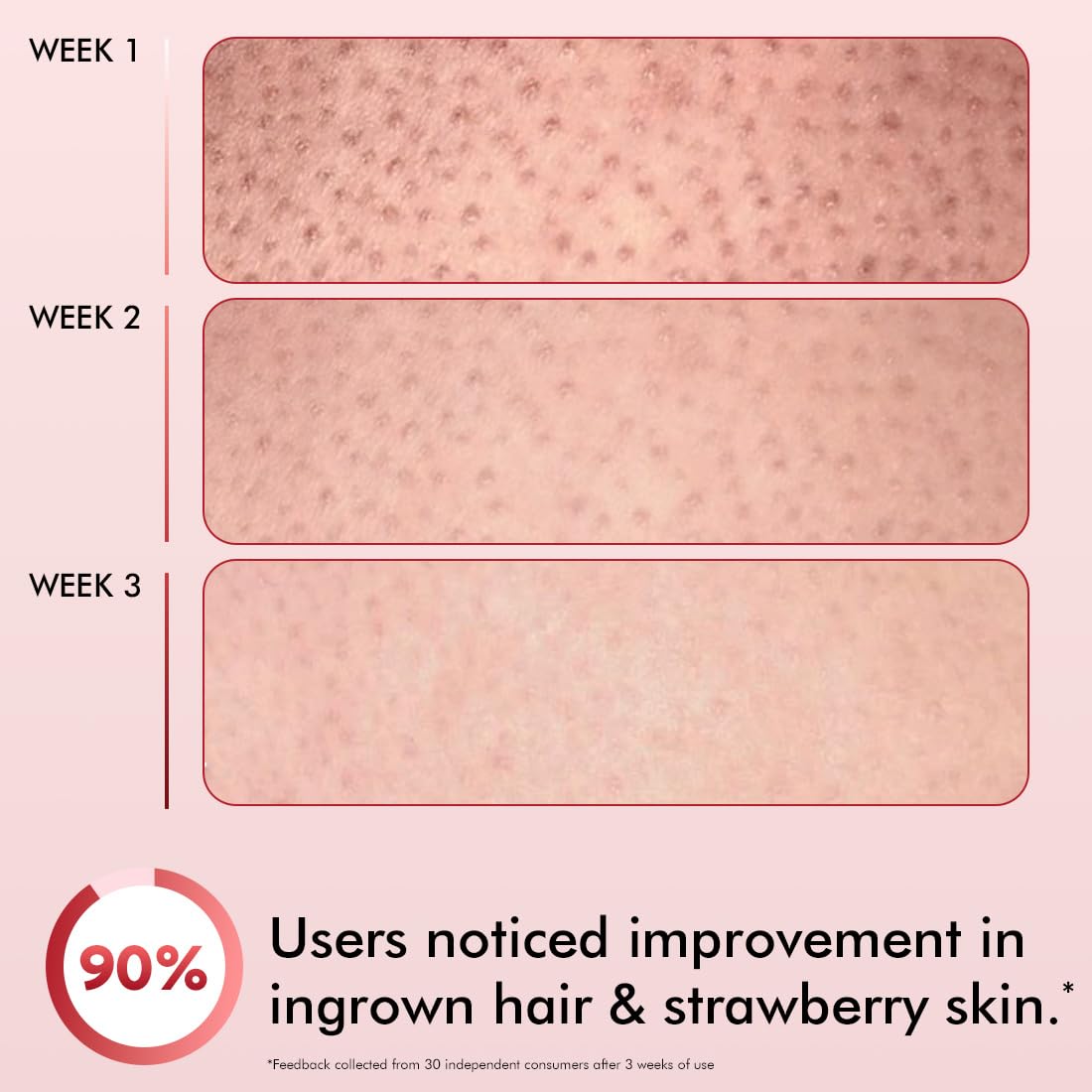 Progression of skin texture over 3 weeks with a 90% improvement rate in ingrown hair and strawberry skin.