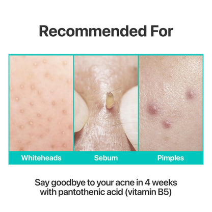 numbuzin No.1 Pantothenic B5 Active Soothing Cream | Remove sebum and skin troubles, Pantothenic acid, Korean Skincare Gift for Women | 80 gm