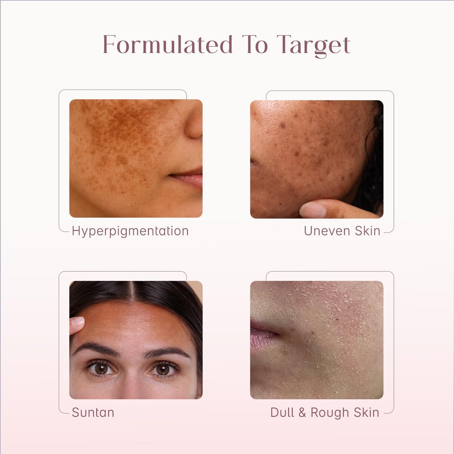 Seoulskin Kojic Acid Skin Lightening Cream with Kojic Acid, Niacinamide & Alpha Arbutin |Moisturizer | Skin Brightening | For Glowing Skin | Treats Dark Spots & Pigmentation | Tan Removal | For Men & Women