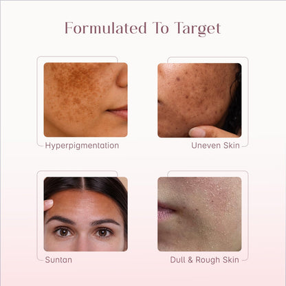 Seoulskin Kojic Acid Skin Lightening Cream with Kojic Acid, Niacinamide & Alpha Arbutin |Moisturizer | Skin Brightening | For Glowing Skin | Treats Dark Spots & Pigmentation | Tan Removal | For Men & Women