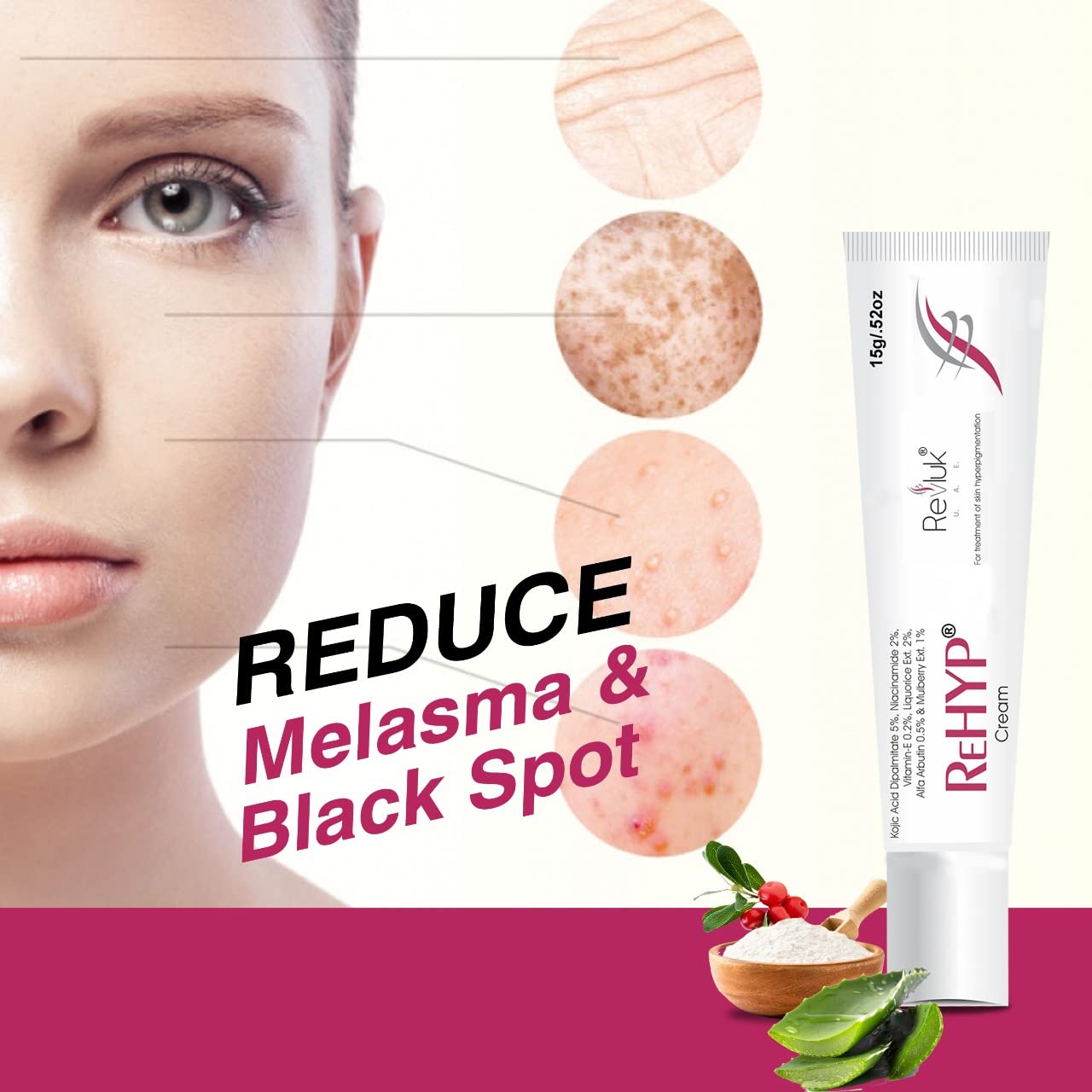 Rehyp Pigmentation Cream for Women – Dark Spot Remover, Brightening Face Cream with Kojic Acid & Alpha Arbutin – Paraben-Free, Dermatologically Tested – 15g