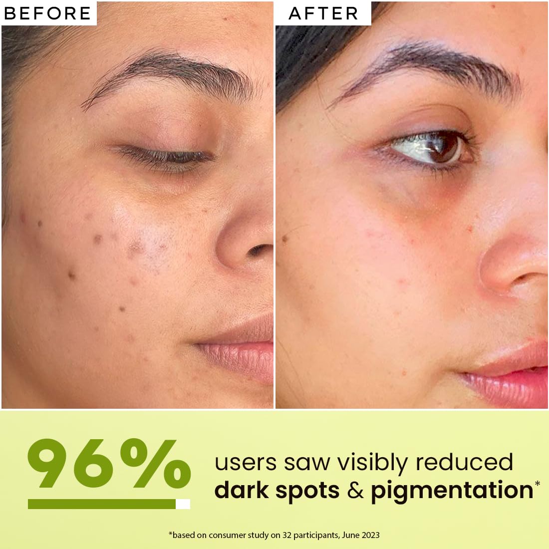 Before and after comparison of a person's face with text indicating 96% reduction in dark spots and pigmentation.
