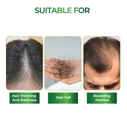 Product suitable for hair thinning, baldness, hair fall, and receding hairline with images and text on a white background.