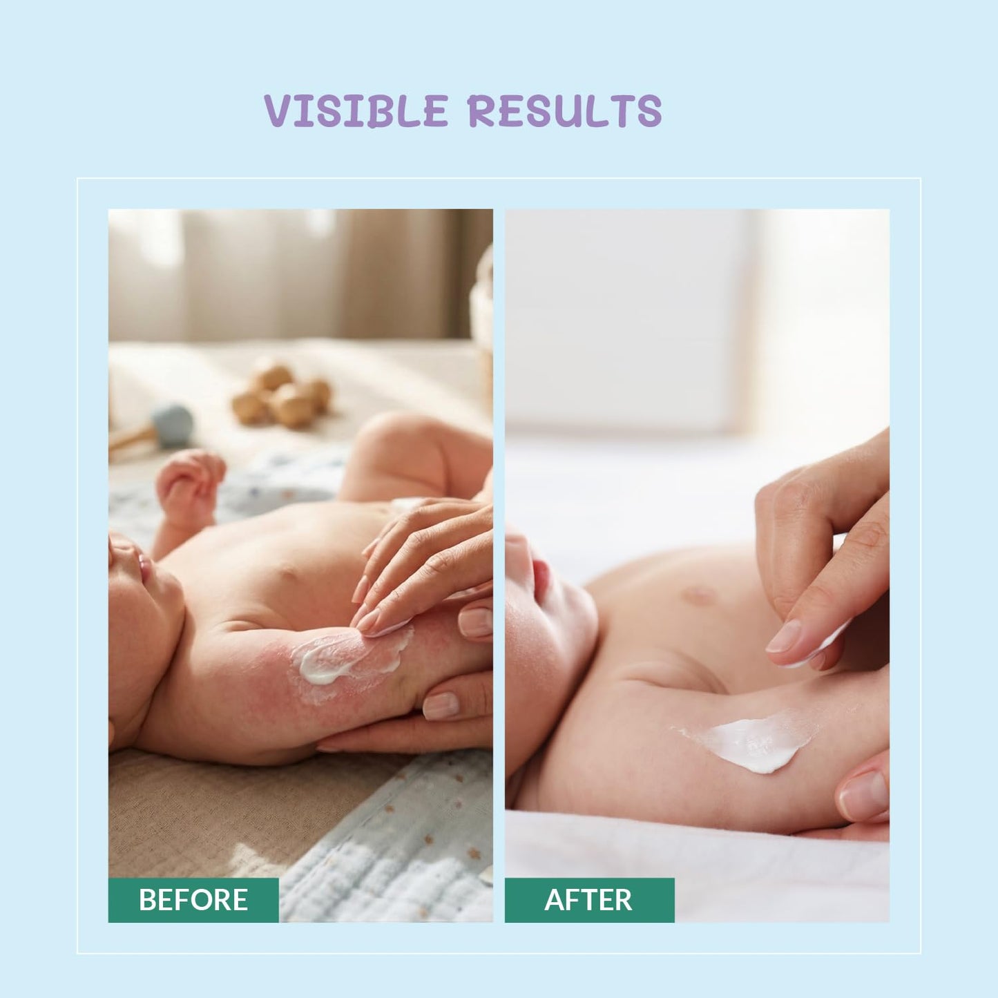 AreoVeda Ceramide Baby Lotion (200ml) | With Ceramides, PENTAVITIN® and Oats Extract | Long Lasting Hydration | Strengthens Skin Moisture Barrier