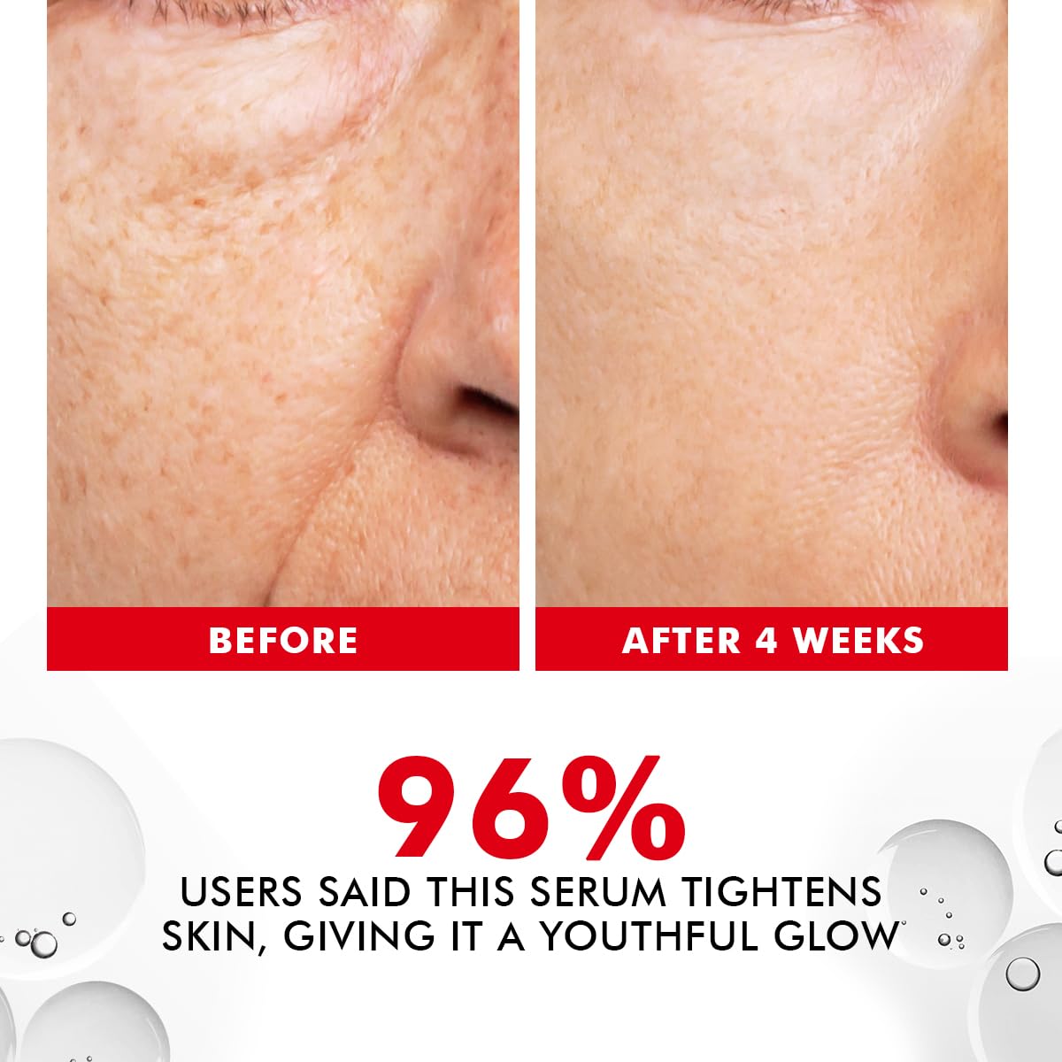 Before and after comparison of skin treatment with text indicating serum effectiveness.