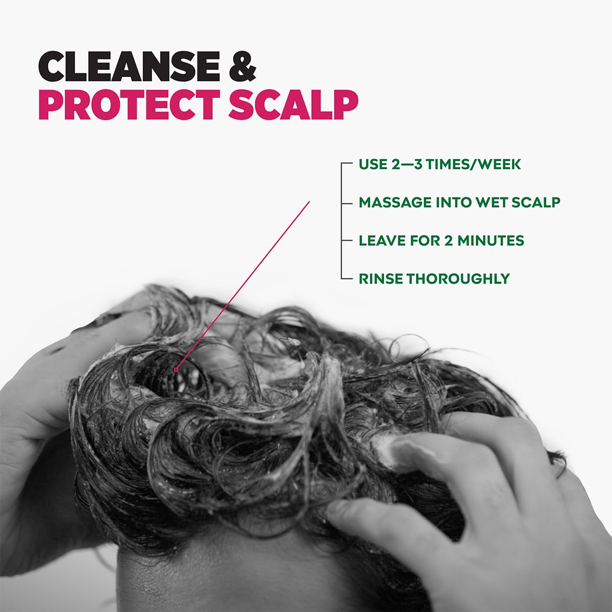 Sebamed Anti Dandruff Shampoo | 200 ml