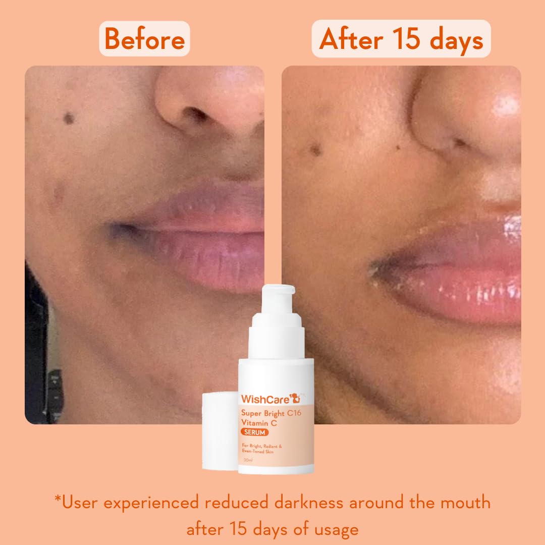 Before and after comparison of skin around the mouth with a WishCare product shown.