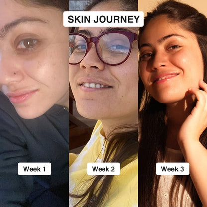 Cos-IQ 23% Vitamin C Face Serum for Glowing Skin 30ml| Advanced Molecular Skincare Technology | Highly Stable, Non Irritating, Non Sticky| Brightening & Hydrating Formula For Men & Women