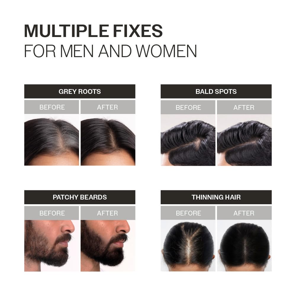 Before and after hair treatment results for men and women with various hair issues.
